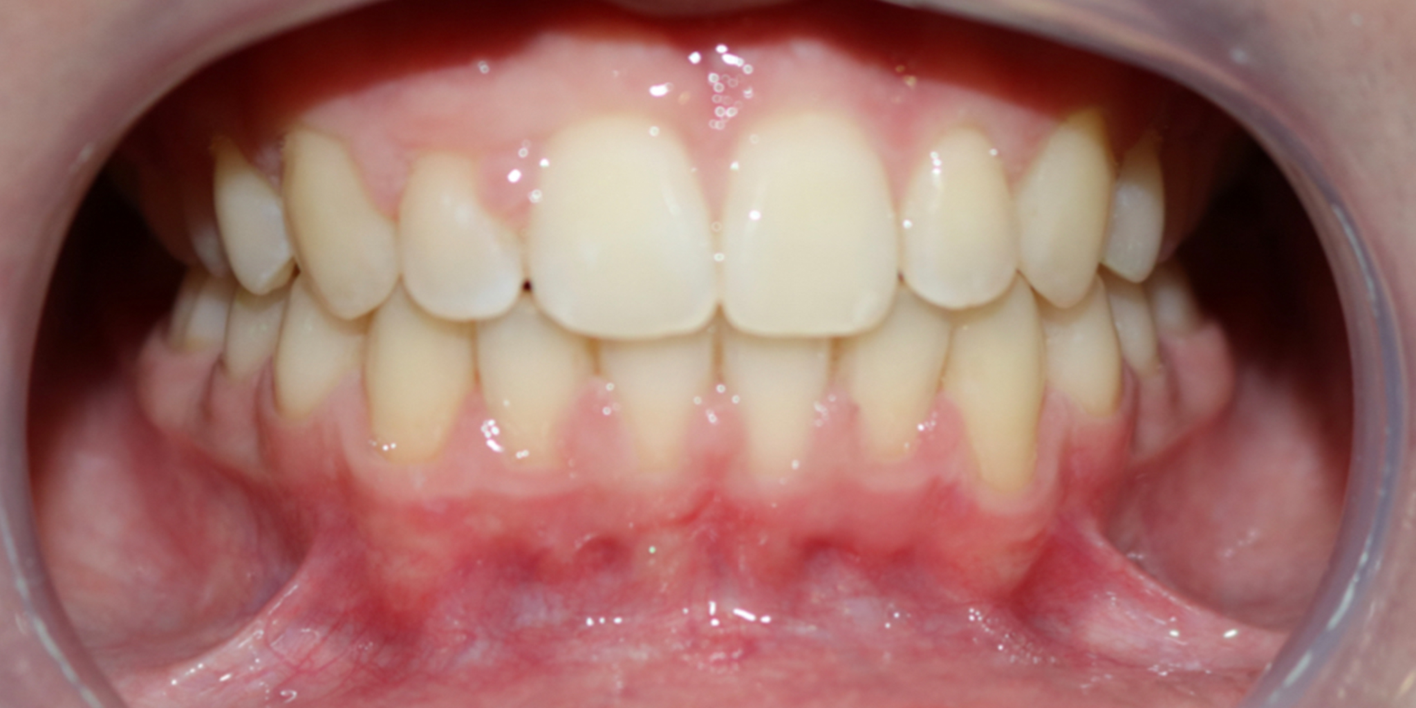 After-Ortodontia