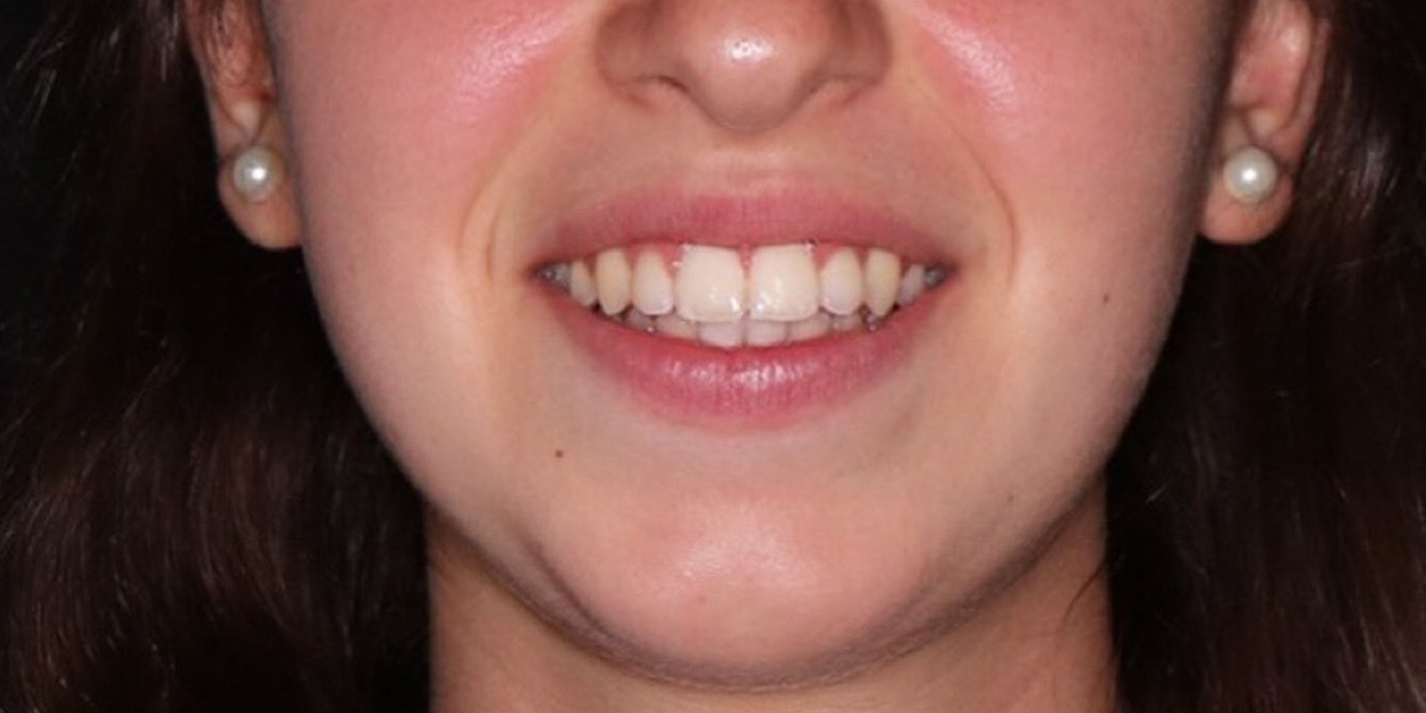 After-Ortodontia